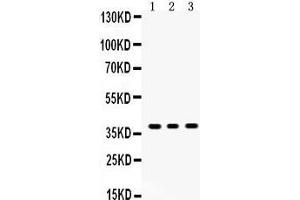 Anti- SIRT6Picoband antibody, Western blotting All lanes: Anti SIRT6  at 0.