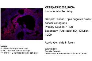 Immunohistochemistry (IHC) image for anti-Keratin 8 (KRT8) (N-Term) antibody (ABIN2777112)