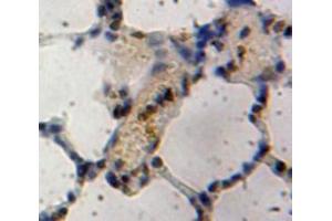 Used in DAB staining on fromalin fixed paraffin-embedded Lung tissue (Inhibitory Subunit of NF-KappaB zeta (AA 422-651) Antikörper)