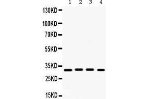 Western Blotting (WB) image for anti-Kv Channel Interacting Protein 2 (KCNIP2) (AA 78-112), (N-Term) antibody (ABIN3043273)