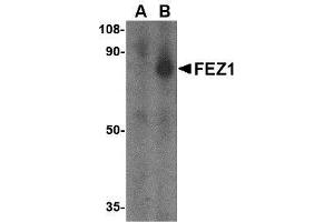 Western blot analysis of FEZ1 in SK-N-SH cell lysate with AP30333PU-N FEZ1 antibody at 1 μg/ml in the (A) presence and (B) absence of blocking peptide. (FEZ1 Antikörper  (C-Term))