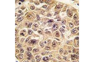 Immunohistochemistry (IHC) image for anti-Ubiquitin (Ub) (AA 1-32) antibody (ABIN3029419)