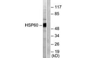 Western blot analysis of extracts from COLO205 cells, using HSP60 Antibody. (HSPD1 Antikörper  (AA 511-560))