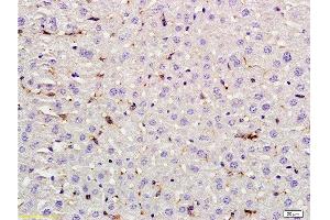 Formalin-fixed and paraffin embedded rat liver labeled with Rabbit Anti LIF Polyclonal Antibody, Unconjugated  at 1:200 followed by conjugation to the secondary antibody and DAB staining (LIF Antikörper  (AA 101-202))