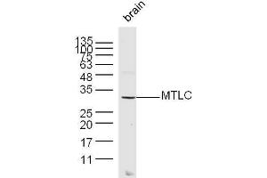 Mouse brain lysates probed with MTLC Polyclonal Antibody, unconjugated  at 1:300 overnight at 4°C followed by a conjugated secondary antibody at 1:10000 for 60 minutes at 37°C. (Myc Target 1 Antikörper  (AA 21-100))