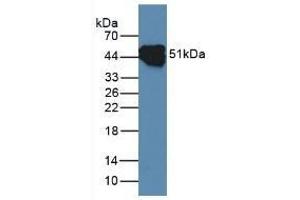 Western Blotting (WB) image for anti-Keratin 14 (KRT14) (AA 111-418) antibody (ABIN7431896)