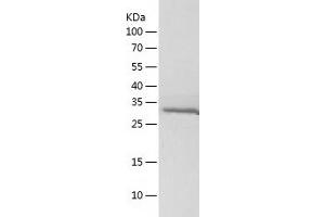 HSD17B1 Protein (AA 1-328) (His tag)