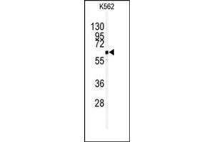 Image no. 1 for anti-Ubiquitin Specific Peptidase 3 (USP3) (C-Term) antibody (ABIN357524) (USP3 Antikörper  (C-Term))