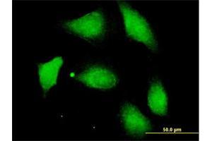 Immunofluorescence of purified MaxPab antibody to PPM1F on HeLa cell. (PPM1F Antikörper  (AA 1-454))