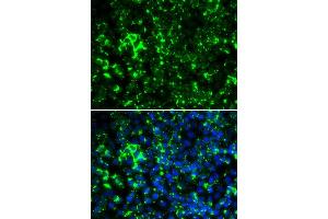 Immunofluorescence (IF) image for anti-Potassium Voltage-Gated Channel, Shaker-Related Subfamily, Member 2 (KCNA2) (AA 1-165) antibody (ABIN6142695)