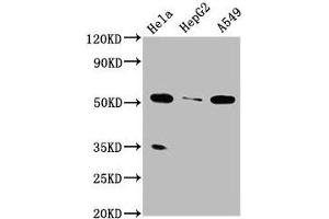 Western Blot Positive WB detected in: Hela whole cell lysate, HepG2 whole cell lysate, A549 whole cell lysate All lanes: MSS51 antibody at 4 μg/mL Secondary Goat polyclonal to rabbit IgG at 1/50000 dilution Predicted band size: 52, 27, 11 kDa Observed band size: 52 kDa (ZMYND17 Antikörper  (AA 258-365))