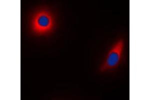 Immunofluorescent analysis of NDUFS1 staining in HeLa cells. (NDUFS1 Antikörper  (C-Term))