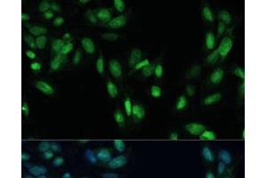 Immunofluorescence analysis of U2OS cells using SMAD7 Polyclonal Antibody at dilution of 1:100. (SMAD7 Antikörper)