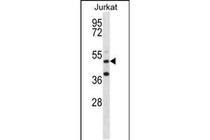 Western blot analysis in Jurkat cell line lysates (35ug/lane). (RBM22 Antikörper  (AA 165-193))