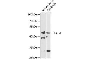 Western blot analysis of extracts of various cell lines, using CCR8 antibody (ABIN6130010, ABIN6138101, ABIN6138102 and ABIN6224067) at 1:1000 dilution. (CCR8 Antikörper  (AA 296-355))