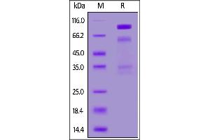 SDS-PAGE (SDS) image for Hepatocyte Growth Factor (Hepapoietin A, Scatter Factor) (HGF) (AA 32-728) (Active) protein (His tag) (ABIN7013376)