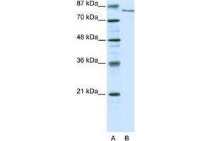 Western Blotting (WB) image for anti-Lysine (K)-Specific Demethylase 2A (KDM2A) antibody (ABIN2460277)