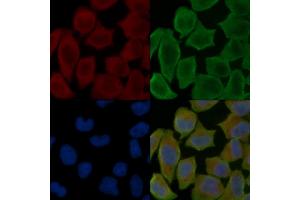 ABIN7096942 and ABIN7101008 staining Hela cells(30 min of UV treatment) by IF/ICC. (C22orf9 Antikörper)