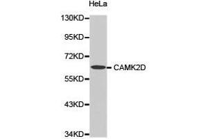 Western Blotting (WB) image for anti-Calcium/calmodulin-Dependent Protein Kinase II delta (CAMK2D) antibody (ABIN1871415) (CAMK2D Antikörper)