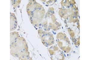 Immunohistochemistry of paraffin-embedded Human stomach using RPLP1 Polyclonal Antibody at dilution of 1:100 (40x lens). (RPLP1 Antikörper)