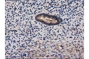 Image no. 9 for anti-Destrin (Actin Depolymerizing Factor) (DSTN) antibody (ABIN1497910) (Destrin Antikörper)