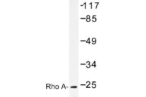 Image no. 1 for anti-Ras Homolog Gene Family, Member A (RHOA) antibody (ABIN272117) (RHOA Antikörper)