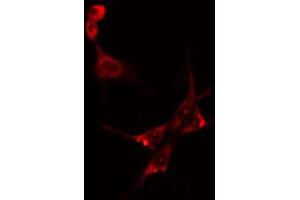 ABIN6274151 staining Hela cells by IF/ICC. (CKM Antikörper  (N-Term))