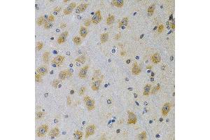 Immunohistochemistry (Paraffin-embedded Sections) (IHC (p)) image for anti-Insulin-Like Growth Factor Binding Protein 4 (IGFBP4) (AA 22-258) antibody (ABIN6142255)