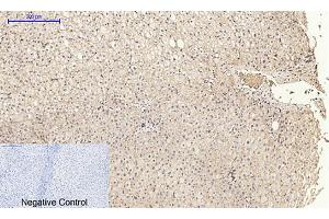 Immunohistochemical analysis of paraffin-embedded human liver tissue.