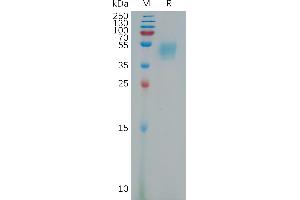 Leucine-Rich alpha-2 Glycoprotein 1 (LRG1) (AA 36-347) protein (His tag)