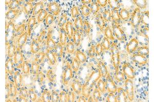ABIN6261431 and ABIN6279416 at 1/100 staining Rat kidney tissue by IHC-P. (EDEM3 Antikörper  (C-Term))