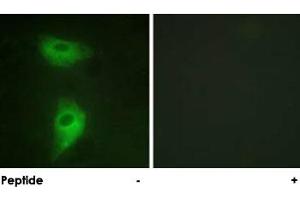 Immunofluorescence analysis of HeLa cells, using IGF2R polyclonal antibody .