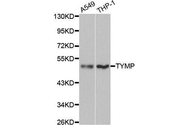 Thymidine Phosphorylase Antikörper  (AA 1-200)