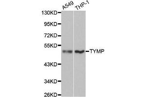 Western blot analysis of extracts of various cell lines, using TYMP antibody. (Thymidine Phosphorylase Antikörper  (AA 1-200))