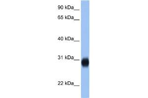 WB Suggested Anti-RAB3D Antibody Titration:  2. (RAB3D Antikörper  (C-Term))