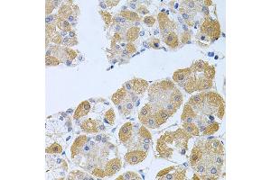 Immunohistochemistry of paraffin-embedded human stomach using PROK2 antibody (ABIN5975051) at dilution of 1/100 (40x lens). (PROK2 Antikörper)