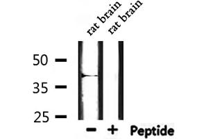 Western blot analysis of extracts from rat brain, using MT-CYB Antibody. (Cytochrome b Antikörper  (N-Term))