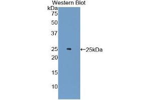 Western blot analysis of the recombinant protein. (Androgen Receptor Antikörper  (AA 491-679))