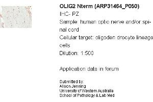 Sample Type: Human Optic Nerve and Spinal CordCellular Target: Oligoden Drocyte Lineage CellsDilution: 1:500 (OLIG2 Antikörper  (N-Term))