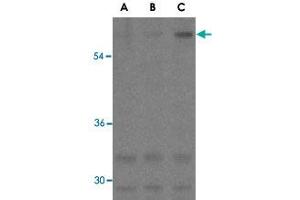 Western blot analysis of ANTXR1 in K-562 cell lysates with ANTXR1 polyclonal antibody  at (A) 0. (ANTXR1 Antikörper)