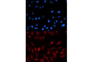 Immunofluorescence analysis of U2OS cells using PA2G4 antibody (ABIN5973112). (PA2G4 Antikörper)