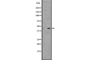 Western blot analysis of GPR87/GPR95 expression in A431 whole cell lysate ,The lane on the left is treated with the antigen-specific peptide. (GPR87 Antikörper  (C-Term))