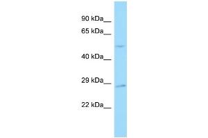 Host: Rabbit Target Name: SNX30 Sample Type: 721_B Whole Cell lysates Antibody Dilution: 1. (SNX30 Antikörper  (C-Term))