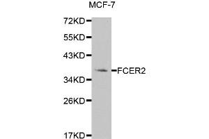 Western blot analysis of extracts of MCF-7 cell line, using FCER2 antibody. (FCER2 Antikörper)