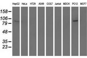 Western blot analysis of extracts (35 µg) from 9 different cell lines by using anti-RASD2 monoclonal antibody. (RASD2 Antikörper)