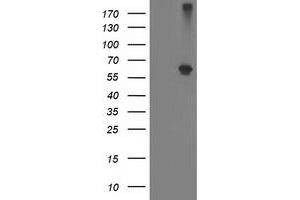 Western Blotting (WB) image for anti-Alcohol Dehydrogenase 1B (Class I), beta Polypeptide (ADH1B) antibody (ABIN1496479)