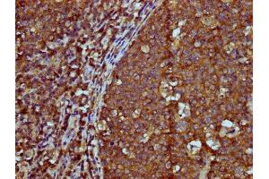IHC image of ABIN7156089 diluted at 1:600 and staining in paraffin-embedded human tonsil tissue performed on a Leica BondTM system. (IGHM Antikörper  (AA 45-178))