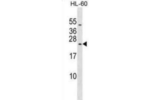 Western Blotting (WB) image for anti-Ribosomal Protein L10L (RPL10L) antibody (ABIN2999579) (RPL10L Antikörper)