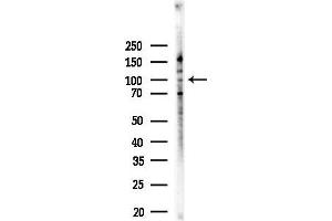 Western blot analysis of lysates from EC304 cells, using Band 3/AE 1 Antibody at 1/1000 dilution.