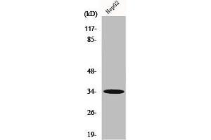 Western Blot analysis of HepG2 cells using Chemokine Receptor D6 Polyclonal Antibody (CCBP2 Antikörper  (C-Term))